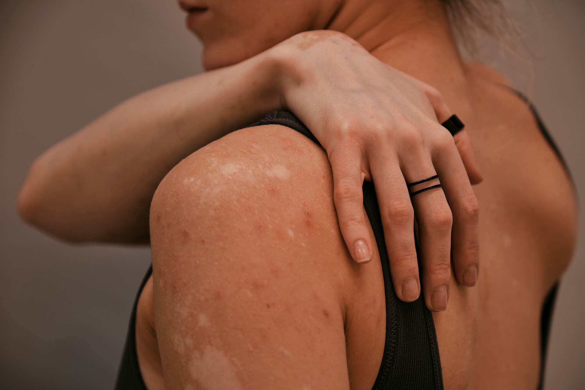 skin warning
