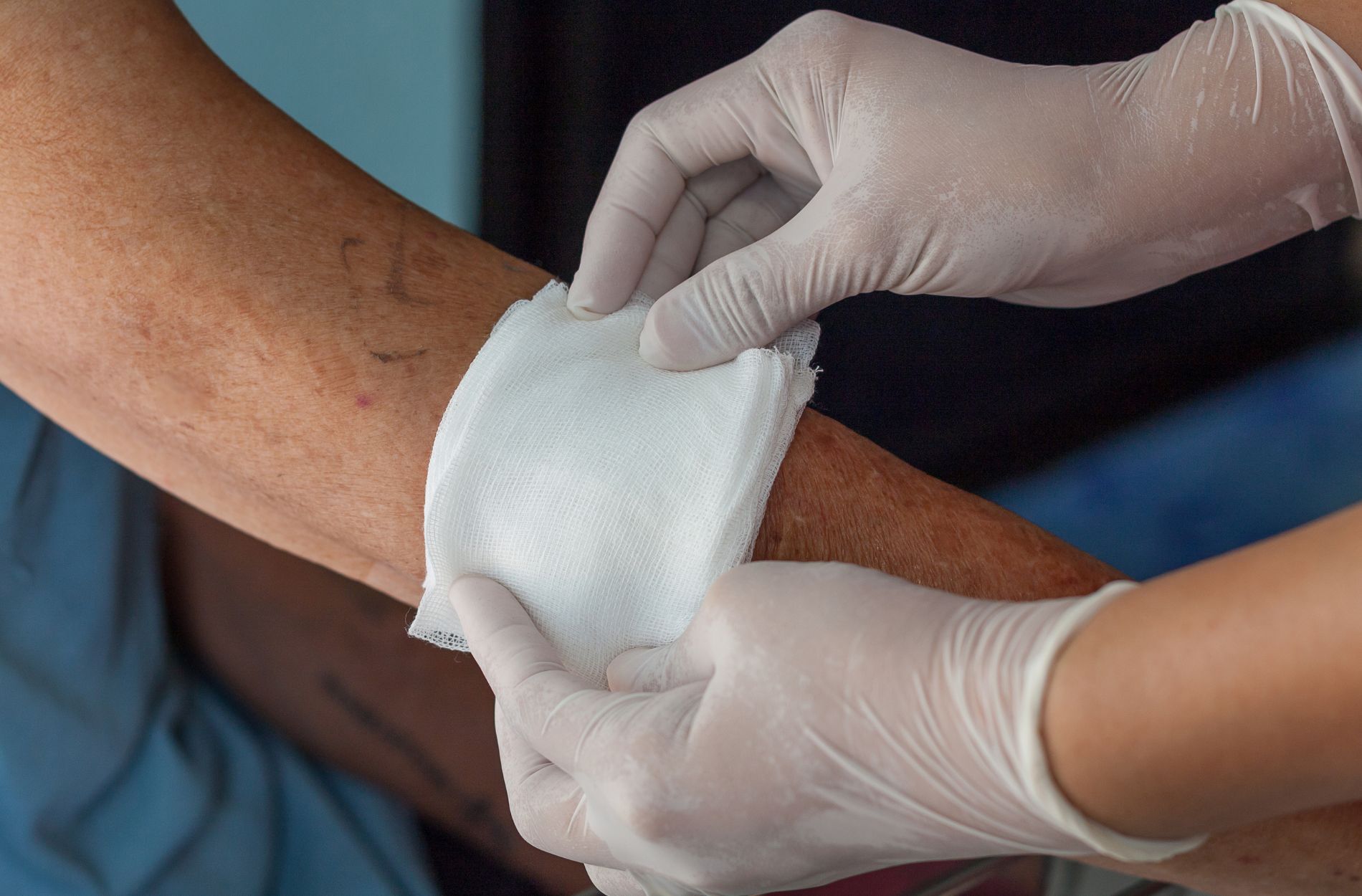 wound care